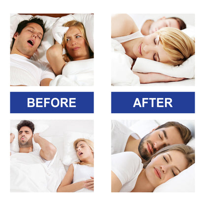 West&Month™ Advanced Sleep Mouth Strips for Snoring Relief & Sleep Apnea – 30 Count